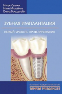 Книга Зубная имплантация. Новый уровень протезирования