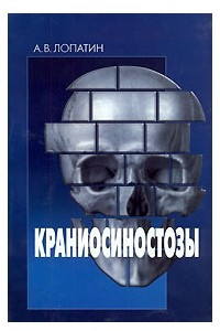 Книга Краниосиностозы