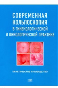 Книга Современная кольпоскопия в гинекологической и онкологической практике