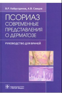 Книга Псориаз. Современные представления о дерматозе. Руководство для врачей