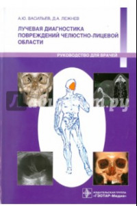 Книга Лучевая диагностика повреждений челюстно-лицевой области