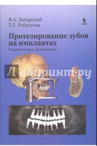 Книга Протезирование зубов на имплантатах