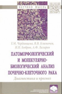 Книга Патоморфологический и молекулярно-биологический анализ почечно-клеточного рака.Диагностика и прогноз