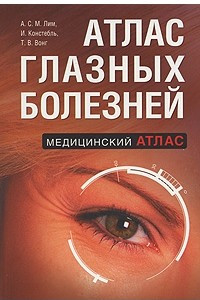 Книга Атлас глазных болезней