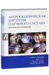Книга Артроскопическая хирургия плечвого сустава. Практическое руководство
