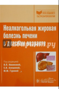 Книга Неалкогольная жировая болезнь печени в детском возрасте. Руководство. Библиотека врача-специалиста