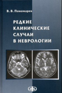 Книга Редкие клинические случаи в неврологии (случаи из практики). Руководство для врачей