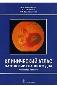 Книга Клинический атлас патологии глазного дна
