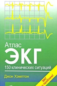 Книга Атлас ЭКГ. 150 клинических ситуаций