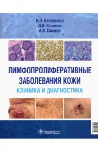 Книга Лимфопролиферативные заболеванания кожи. Клиника и диагностика