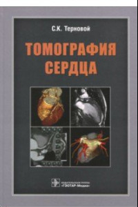 Книга Томография сердца. Руководство для врачей