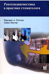 Книга Рентгендиагностика в практике стоматолога