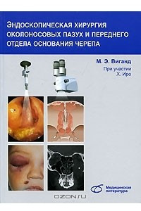 Книга Эндоскопическая хирургия околоносовых пазух и переднего отдела основания черепа