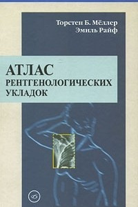 Книга Атлас рентгенологических укладок