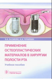 Книга Применение остеопластических материалов в хирургии полости рта