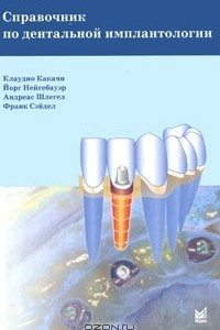 Книга Справочник по дентальной имплантологии