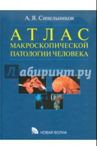 Книга Атлас макроскопической патологии человека