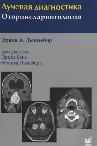 Книга Лучевая диагностика. Оториноларингология