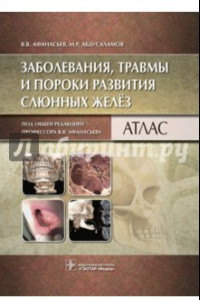 Книга Заболевания, травмы и пороки развития слюнных желёз. Атлас