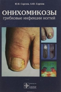 Книга Онихомикозы. Грибковые инфекции ногтей
