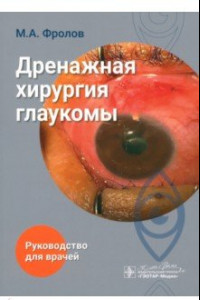 Книга Дренажная хирургия глаукомы