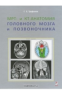 Книга МРТ- и КТ-анатомия головного мозга и позвоночника