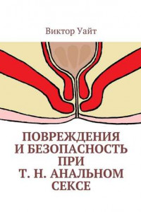 Книга Повреждения и безопасность при т. н. анальном сексе