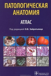 Книга Патологическая анатомия. Атлас