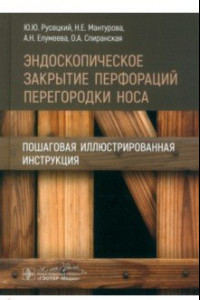 Книга Эндоскопическое закрытие перфораций перегородки носа. Пошаговая иллюстрированная инструкция