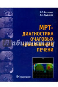 Книга МРТ-диагностика очаговых заболеваний печени
