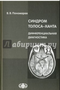 Книга Синдром Толоса-Ханта. Дифференциальная диагностика (случаи из практики). Руководство для врачей