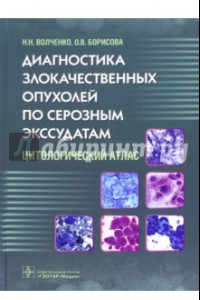 Книга Диагностика злокачественных опухолей по серозным экссудатам. Цитологический атлас