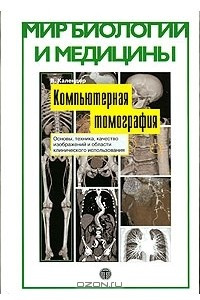 Книга Компьютерная томография. Основы, техника, качество изображений и области клинического использования
