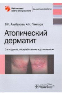 Книга Атопический дерматит