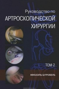 Книга Руководство по артроскопической хирургии. В 2 томах. Том 2