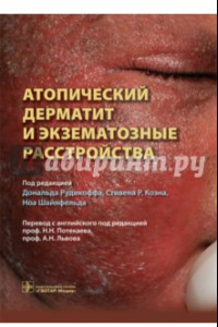 Книга Атопический дерматит и экзематозные расстройства