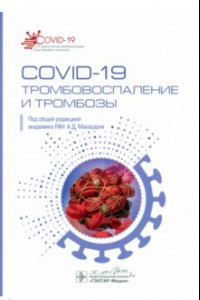 Книга COVID-19. Тромбовоспаление и тромбозы