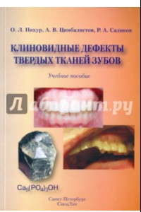 Книга Клиновидные дефекты твердых тканей зубов