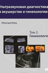Книга Ультразвуковая диагностика в акушерстве и гинекологии. В 2 томах. Том 2. Гинекология