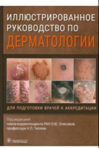 Книга Иллюстрированное руководство по дерматологии. Для подготовки врачей к аккредитации