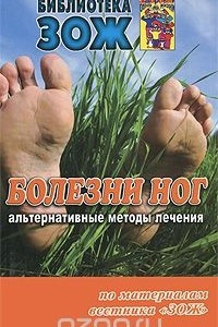 Книга Болезни ног