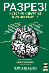 Книга Разрез! История хирургии в 28 операциях