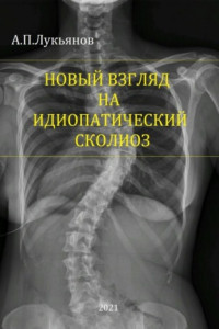 Книга Новый взгляд на идиопатический сколиоз