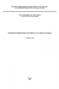 Эндопротезирование крупных суставов человека